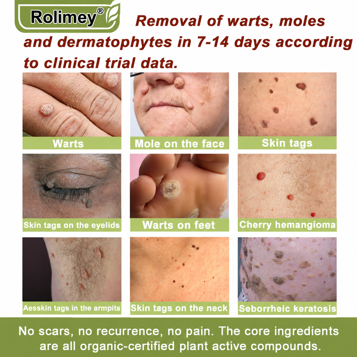 ✅Made in the USA: Rolimey® Magnesium herbal skin repair cream