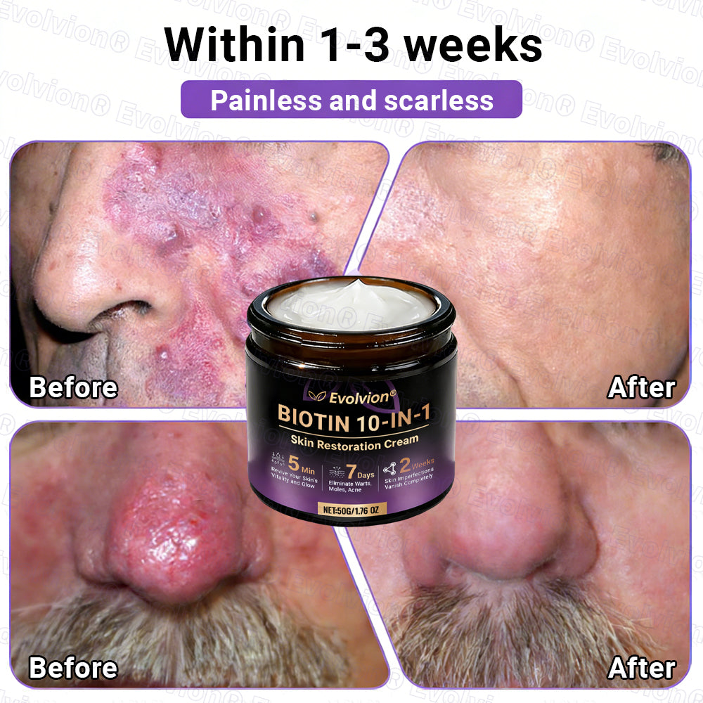 👨‍⚕️Over 100,000 units sold💕-🍁Evolvion® Biotin 10-in-1 Skin Restoration Cream