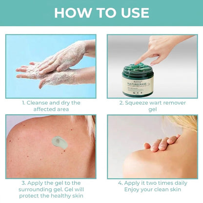✅ Official Store: Rolimey® NatureErase Instant Alligator Oil Mole & Spot Removal Plus Gel