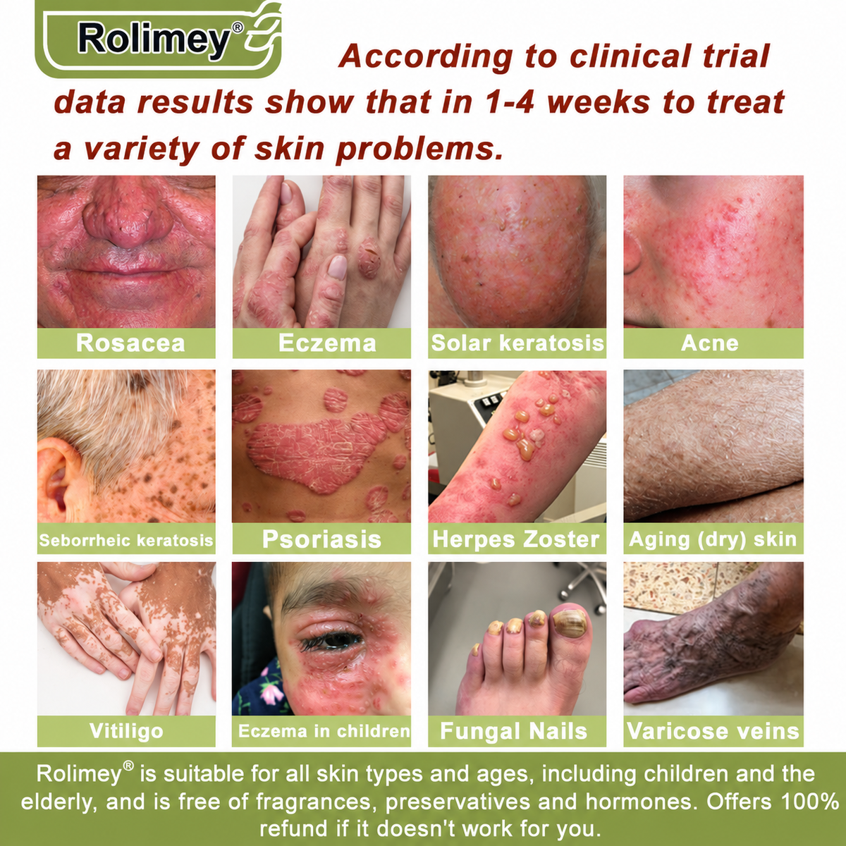 ✅Made in the USA: Rolimey® Magnesium herbal skin repair cream