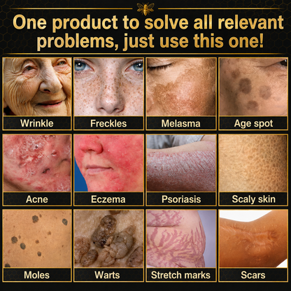 🔥Rolimey® Bee venom Pro Comprehensive Cream —Tightening for Skin Types 🔥
