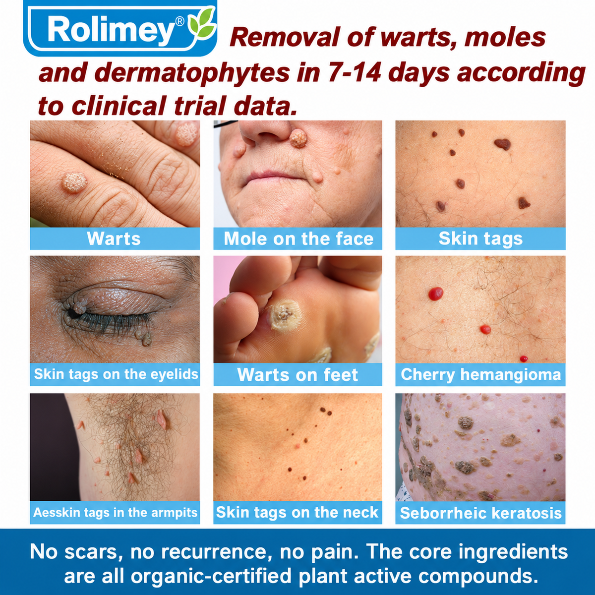 ✅Official Store: Rolimey® Magnesium skin repair cream