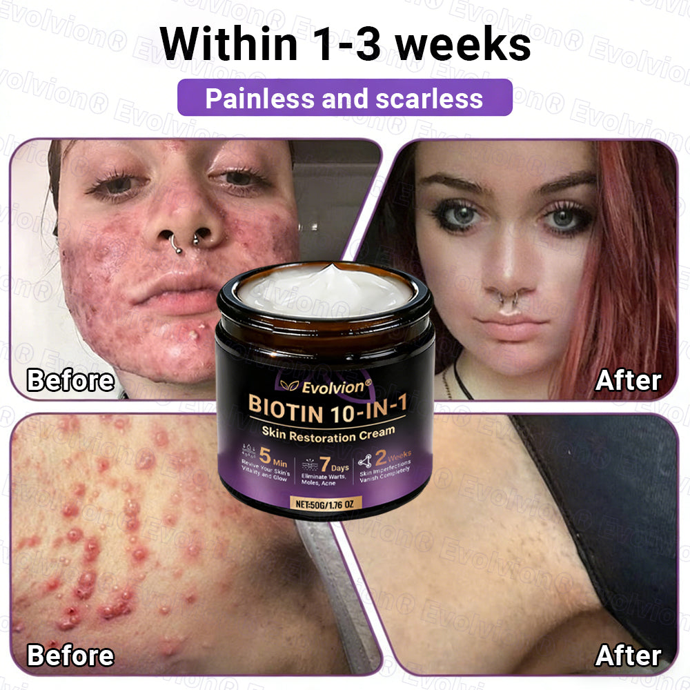 👨‍⚕️Over 100,000 units sold💕-🍁Evolvion® Biotin 10-in-1 Skin Restoration Cream