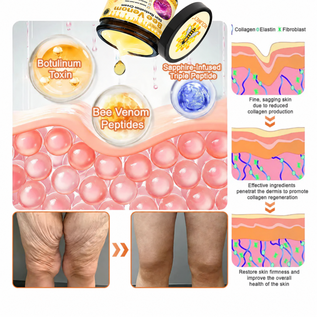 🌟Official Brand Shop丨🐝Rolimey® Bee venom Pro Comprehensive Cream—Tightening for Skin Types
