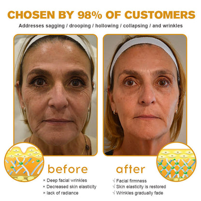 Made in the USA – Furzero™ Botox Bee Venom Wrinkle Removal Cream🇺🇸✨